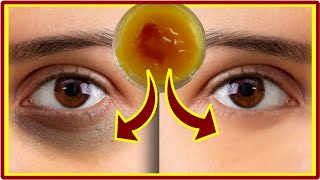 Apply Turmeric Cream for 20 Minutes - It Removes Wrinkles and Bruises Under the Eyes in A Night