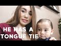 FINDING OUT MY BABY IS TONGUE TIED | UNDIAGNOSED FOR 9 MONTHS