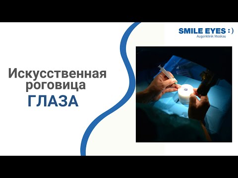 Искусственная роговица глаза 👁 для пересадки - когда появится?