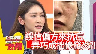誤信偏方來抗痘，弄巧成拙慘變皮膚炎？！【醫師好辣】20200325 part4 EP916 田知學 陳木榮