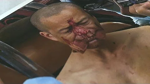 Blood, guts and ribs as Chinese performer suffers for his art - DayDayNews