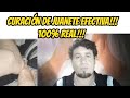 Curando el Juanete!!!, Para toda la Gente!!!, ( SANACIÓN REAL )