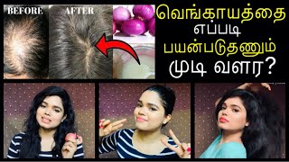 How To Use Onion Juice For Hair Regrowth | Onion Juice For Hair Growth in Tamil | Hair Growth Remedy
