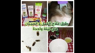 طرق علاج القمل و الصيبان في ليلة واحدة