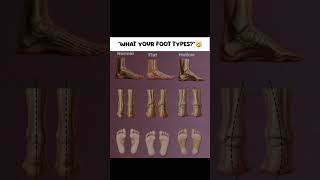 Did Your Foot Type Is Straight