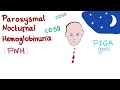Paroxysmal Nocturnal Hemoglobinuria (PNH) | Hemolytic Anemia | Complement Alternative Pathway