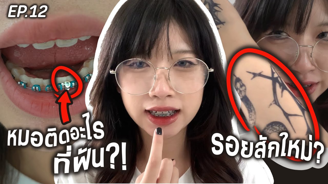 หมอติดอะไรที่ฟัน?! , อวดรอยสักใหม่!!🖤🔥 | update จัดฟัน 11 เดือน EP.12 (มีต่อ) | SOMz