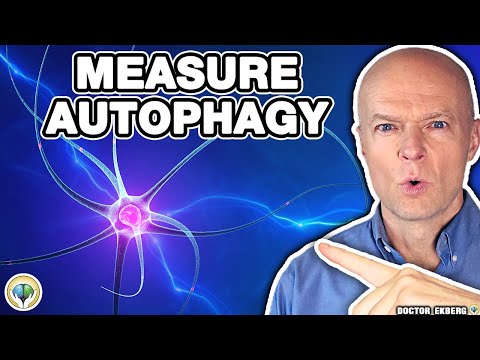 Autophagy & Fasting: How Long To Biohack Your Body For Maximum Health? (GKI)