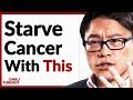 Main Cause Of Cancer? - How It Spreads In The Body &amp; How To STARVE IT With Fasting | Dr. Jason Fung