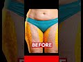Your Hip Dips Aren't The Problem - 15 Min Lower Body Sculpt