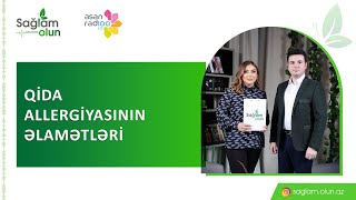 Qida Allergiyasının Əlamətləri I Əstəlik