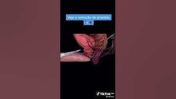 PROSTAT  : GEJALA, PENYEBAB DAN PENGOBATANYA  #INFO SELENGKAPNYA :  #Hub. KLINIK ALTERNATIVE WIENART
