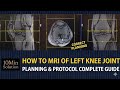 MRI Left Knee Joint | Step-by-Step Positioning & Protocol Guide