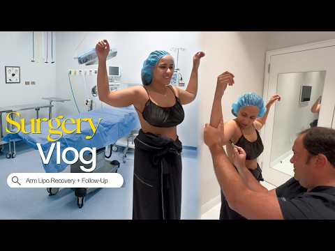 I Finally Got Arm Liposuction | surgery day, before & after + post-op recovery