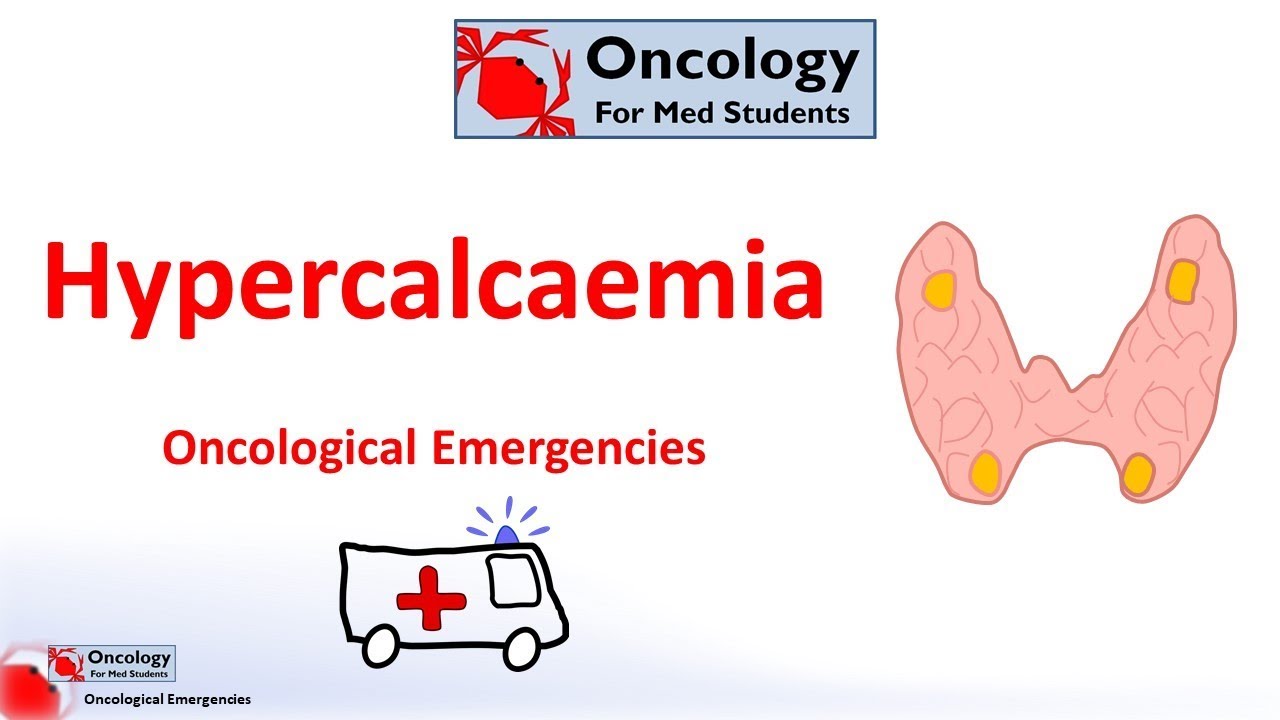 how to diagnose peritoneal cancer