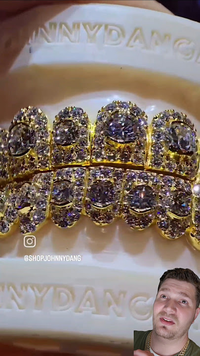 Johnny Dang! The Contrast of the Yellow Gold & The Diamonds used in This Grill is Perfection #shorts