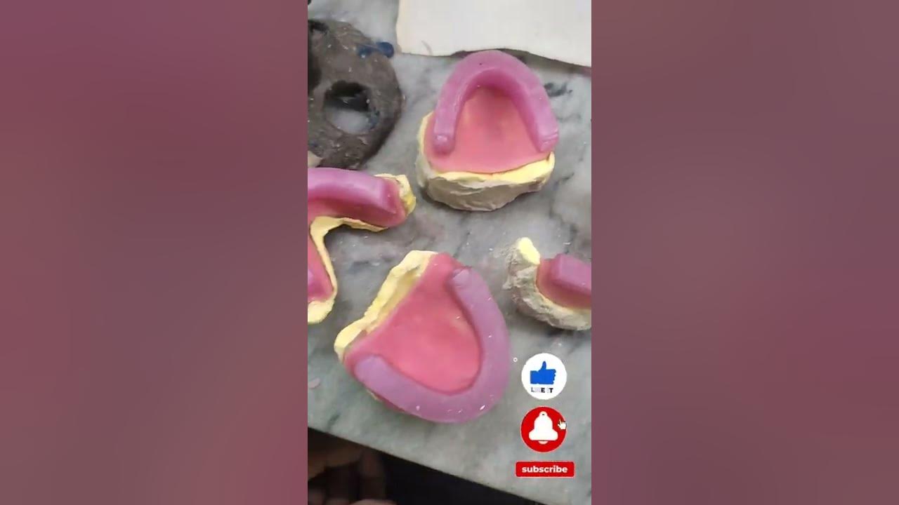 Complete Denture Bite Complete Denture jaw relation Bite