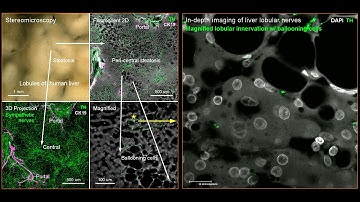 Panoramic-to-3D Airyscan super-resolution neurohistology of human liver with steatosis (1080p HD)