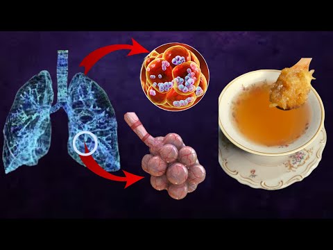 Slimming, detox natural remedy for flu and cold - protect respiratory organs
