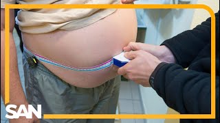Body roundness index more accurate than BMI to measure obesity: Report