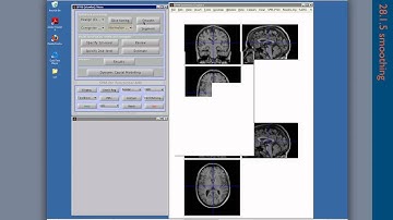 Test: SPM8 tutorial (MoAE)
