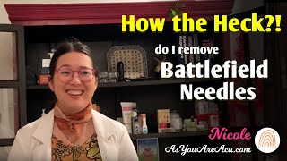 HOW THE HECK do I remove Battlefield Acupuncture needles