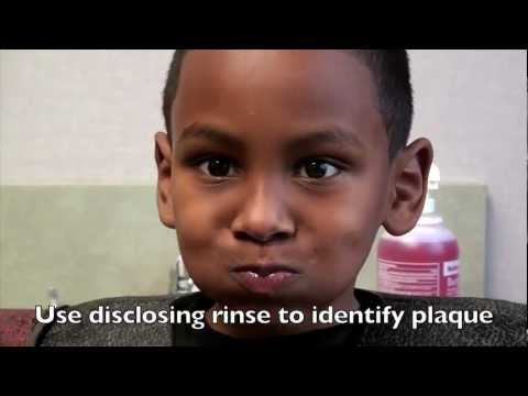 Candy and Cavities - Dr. Zamora's simple fix!