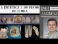 A estética e os pinos de fibra - conteúdo da LIVE 4