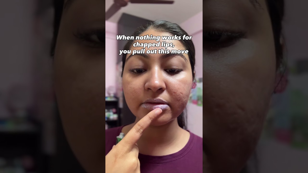 Boroline for chapped dry lips 