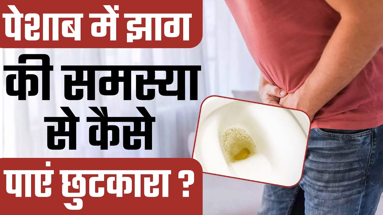 पेशाब में झाग की समस्या क्यों होती है? Foam in Urine Foamy Urine