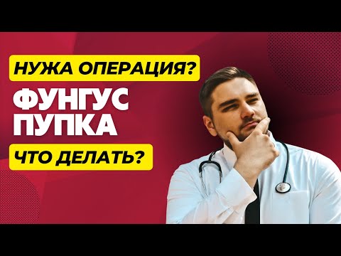 Фунгус пупка | Почему у ребенка мокнет пупок? | Кровь и слизь в пупке | Не заживает пупочная ранка