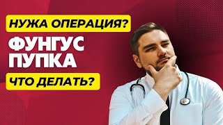 Фунгус пупка | Почему у ребенка мокнет пупок? | Кровь и слизь в пупке | Не заживает пупочная ранка