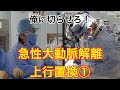 急性大動脈解離 上行置換 ① ２時間半で終われますか？　Ascending Aortic Replacement for Acute Aortic Dissection 【俺に切らせろ！】