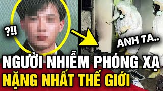 Chàng Trai Người Nhật Nhiễm Phóng Xạ Nặng Nhất Thế Giới Và 83 Ngày Địa Ngục Tin 3 Phút