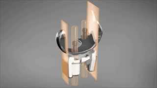 ConforMIS iUni & iDuo Knee Resurfacing Implants - MDEA 2009 Gold Winner
