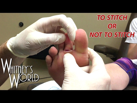 Gymnastics Injury | To Stitch or Not To Stitch | Whitney Bjerken