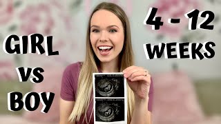 1ST TRIMESTER RECAP: First vs Second Pregnancy | Girl vs Boy Symptoms | Week 4 - 12 Pregnancy Update screenshot 5