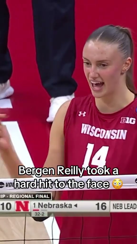 Hard hit to the face ?