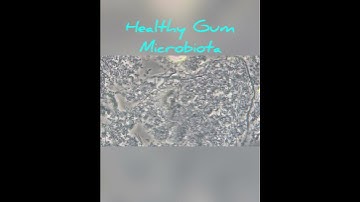 Healthy Gum microbiota
