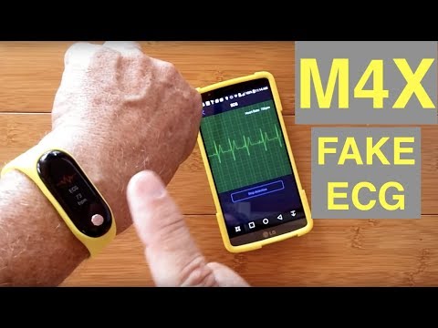 Bakeey M4X Fitness Band with FAKE ECG, Poor Construction, Defective Charging System: DO NOT BUY