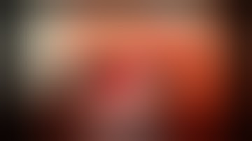 Microvascular decompression for trigeminal neuralgia