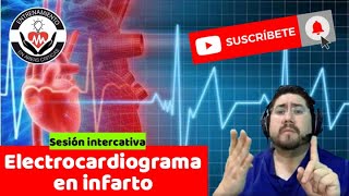 Reto de Electrocardiograma en infarto! Estas listo? By Dr. Zamarrón