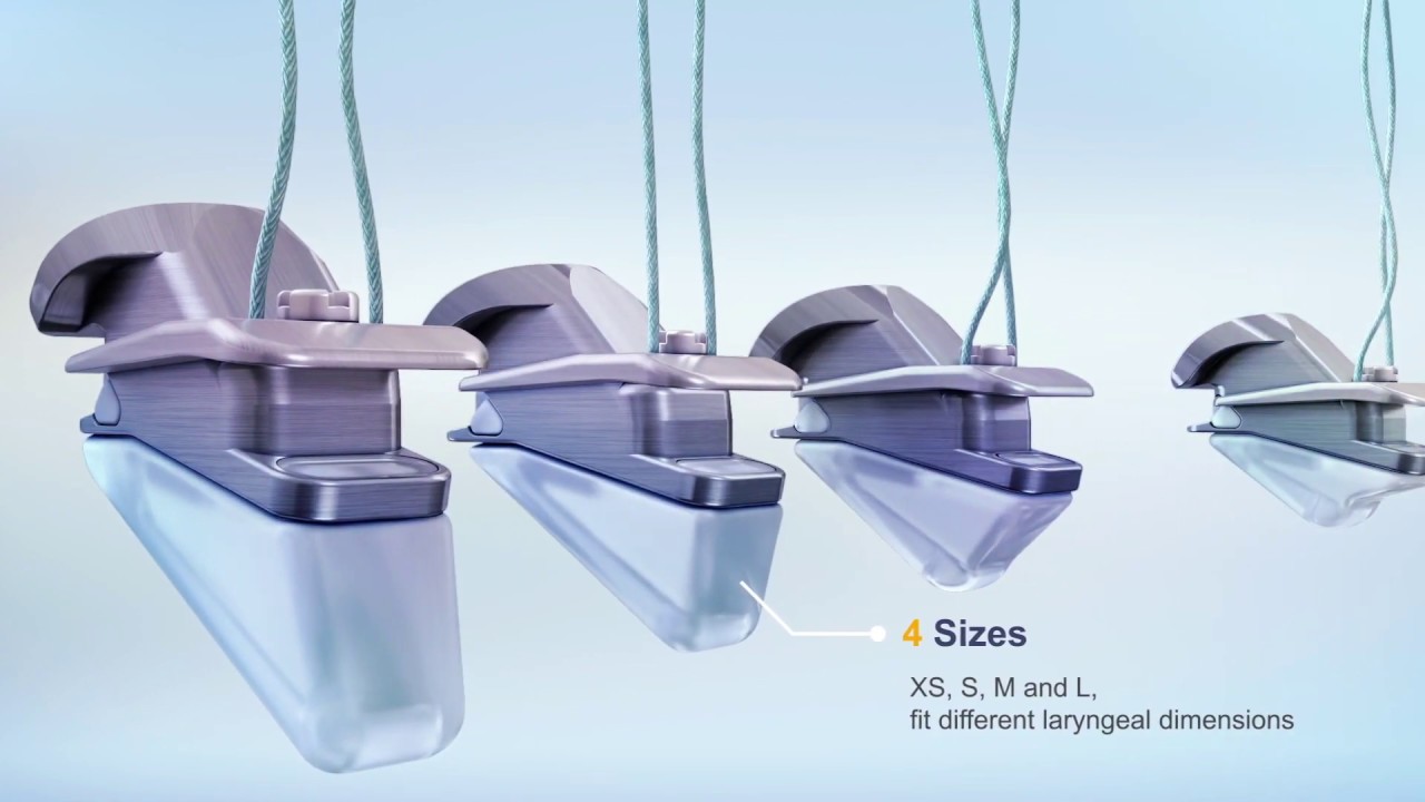 APrevent® VOIS (VOCAL IMPLANT SYSTEM) YouTube