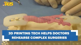 3D printing technology helps surgeons rehearse complex surgeries: HealthLink