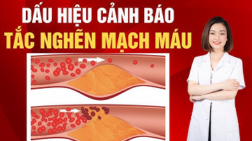 7 Dấu hiệu cảnh báo mạch máu đang tắc nghẽn, đừng để đến khi quá muộn | Dr Thu Hằng