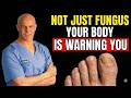 Stop Treating It Like Fungus Until You Watch This — What Yellow Toenails Actually Mean After 50