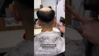 Система волос интеграция в центре дизайна волос, Санкт-ПетербургWhatsApp +79215710124