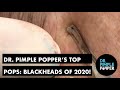 Dr. Pimple Popper's Top Pops: Blackheads!!