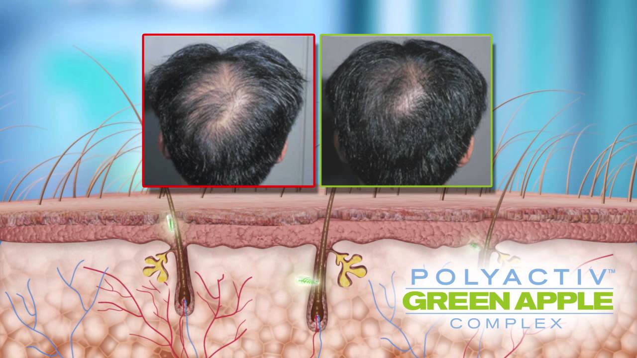 PolyActive Green Apple Overview