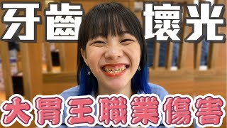 大胃王職業傷害Part2! 整口牙齒全壞光!? 花57萬做假牙😰？【路生活】
